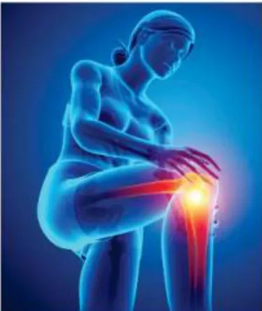 Musculação para pessoas pós-cirurgia de joelho