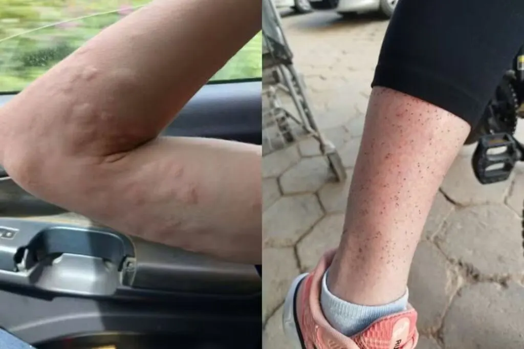 Moradores de Ilhota enfrentam infestação de maruim há anos
