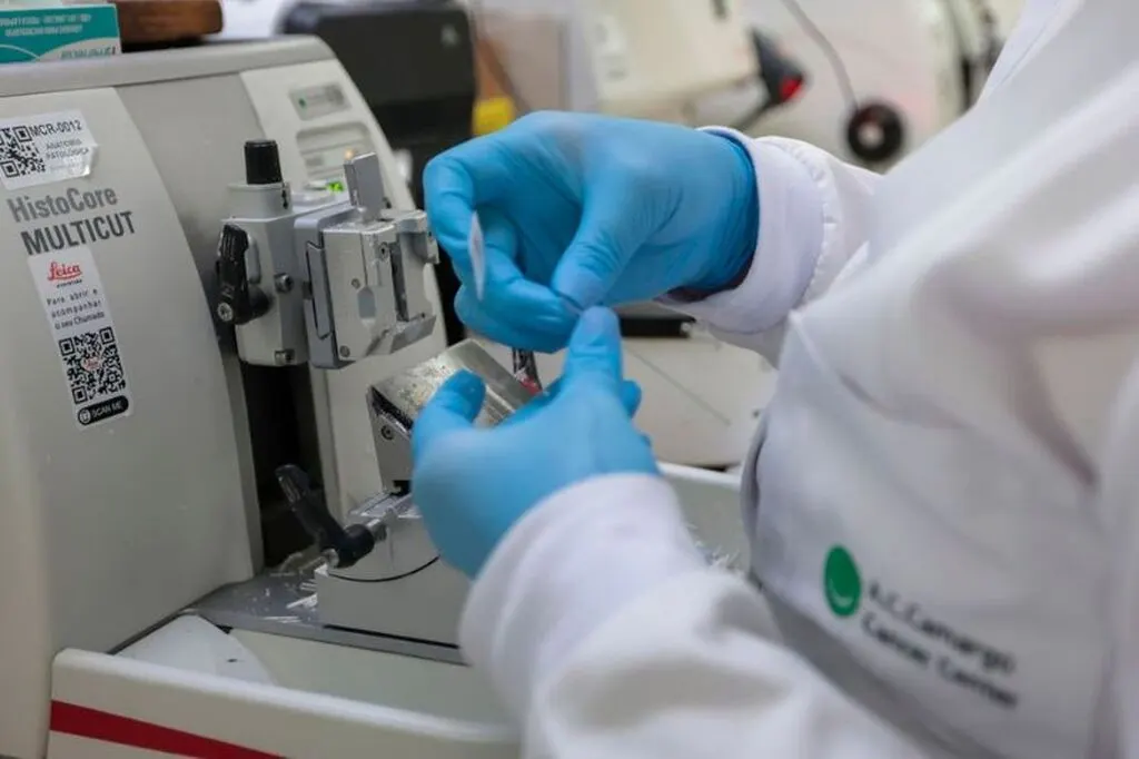 SUS incorpora nova terapia para pacientes com leucemia mieloide aguda