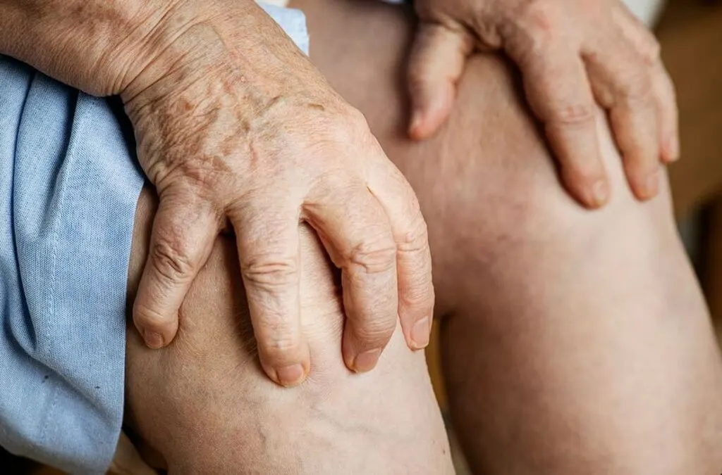 O que é tromboflebite superficial e como identificar os sintomas